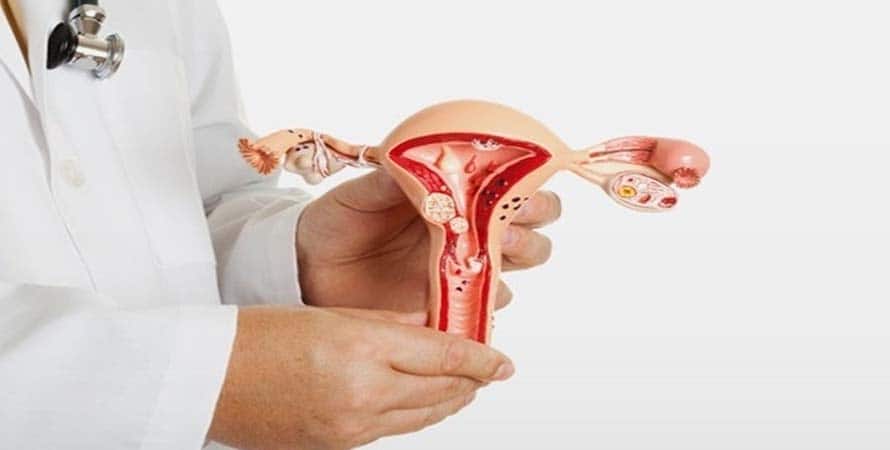 Principais Causas da endometriose