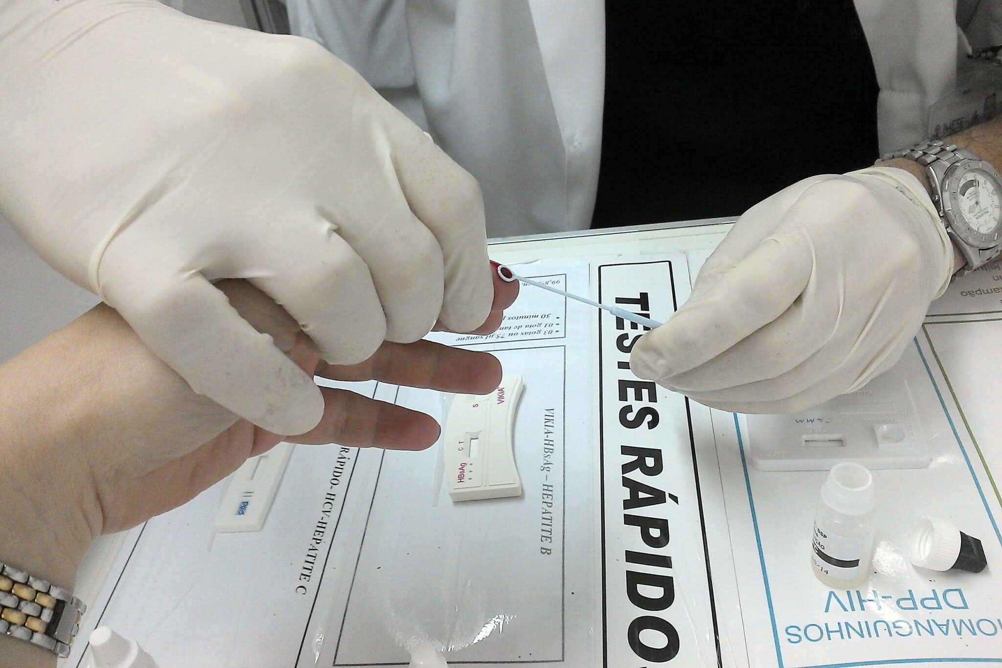 Campanha leva teste rápido de HIV às UBSs Osasco Notícias