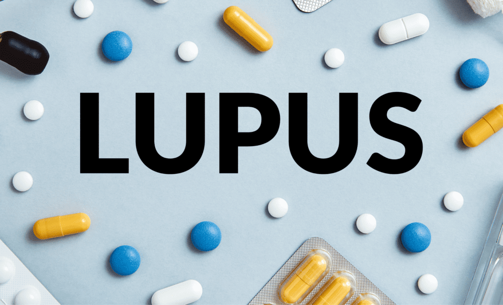 Sinais de Lúpus: Conheça os Indícios Precoces - Osasco Notícias